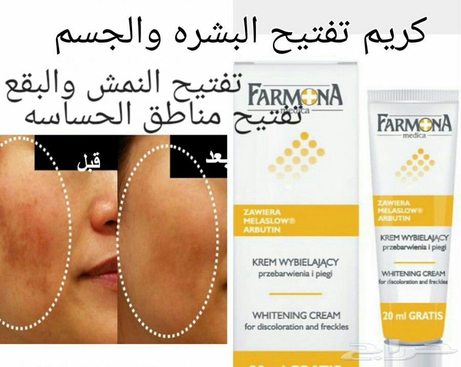 كريم لمحاربه النمش