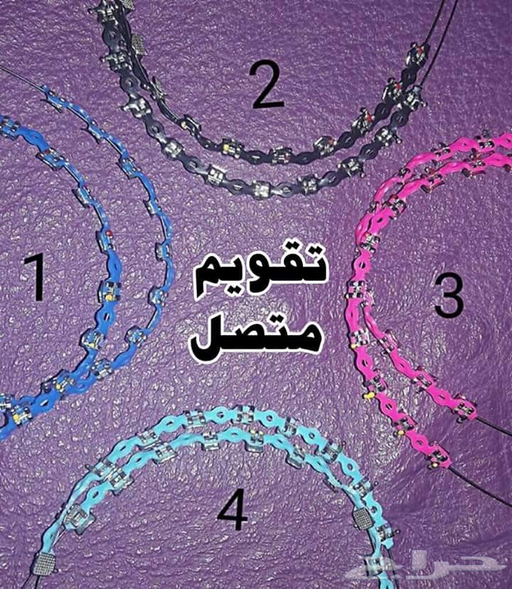 تقويم الأسنان يتركب بالبيت 250 ريال