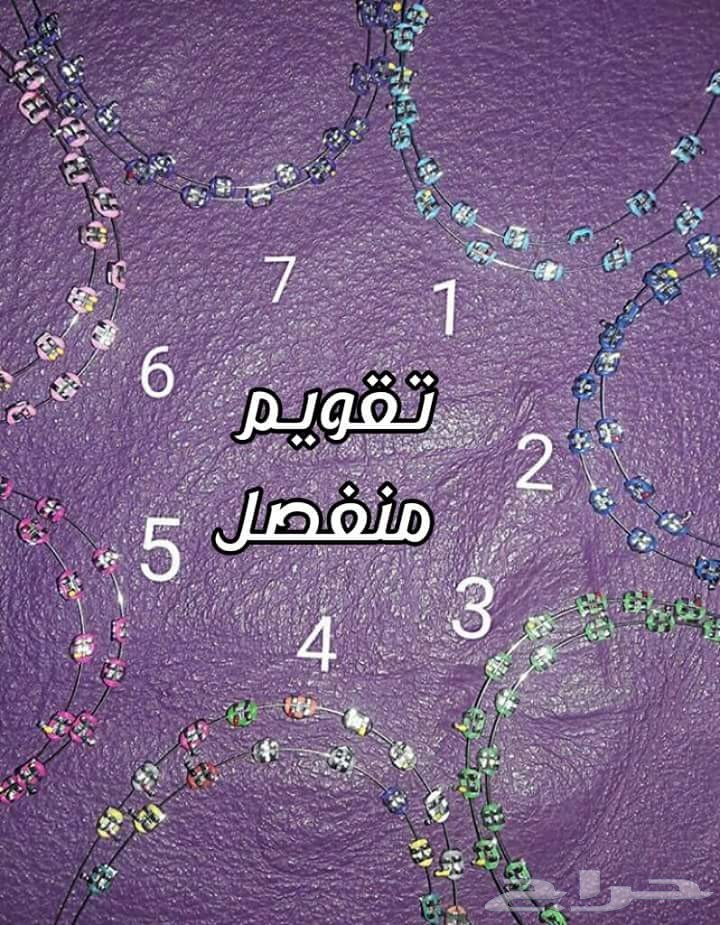 تقويم الأسنان يتركب بالبيت 250 ريال